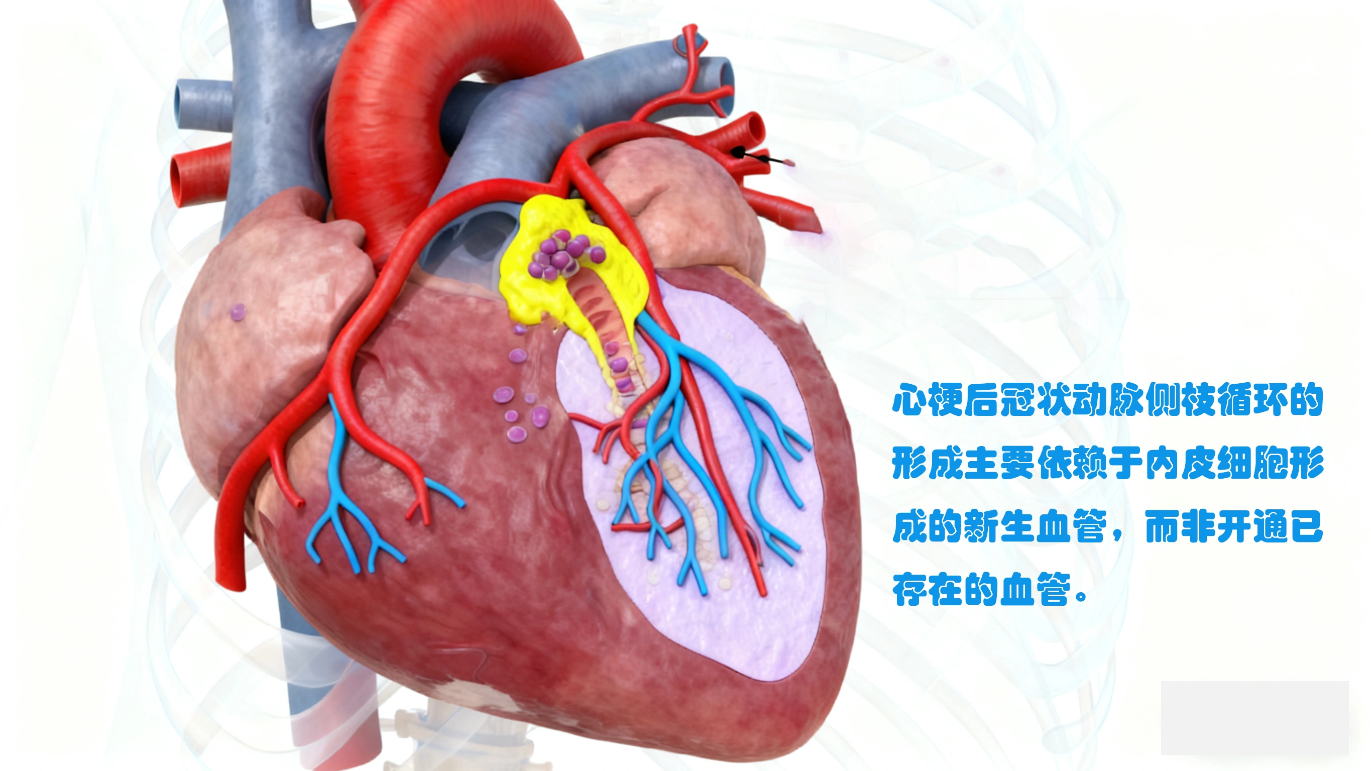 心梗后冠状动脉侧枝循环生成的影响因素及临床意义