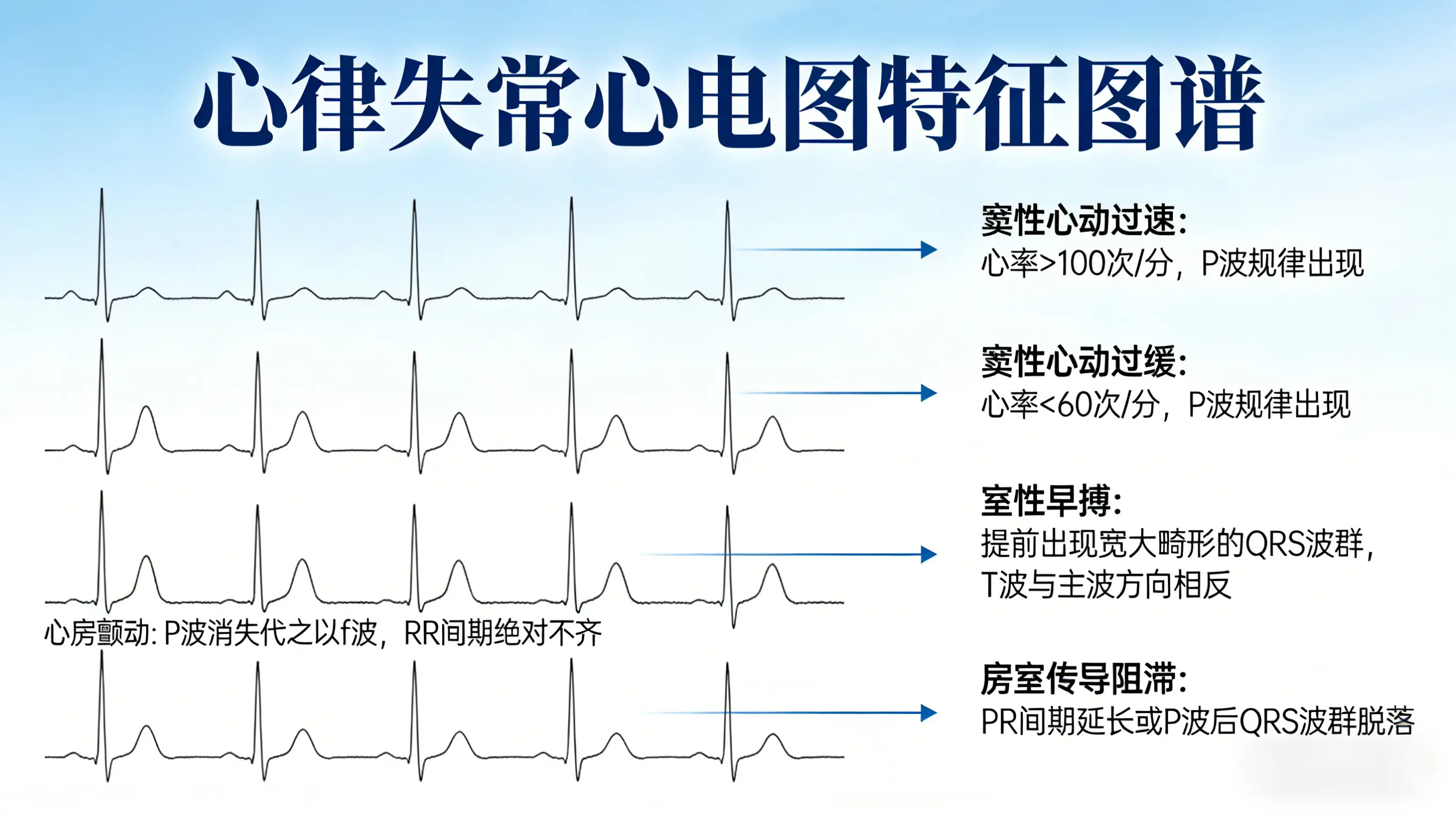 心律失常：发病原因、症状、危害与治疗全解析